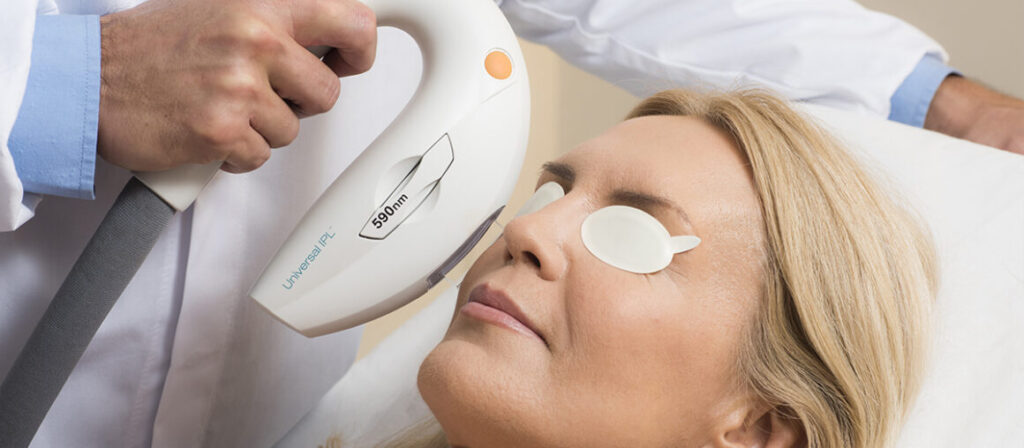 A woman is lying down with her eyes covered by protective pads while receiving an IPL (Intense Pulsed Light) treatment. A medical professional, partially visible, is holding an IPL device marked with "590nm" and "Universal IPL." The device is aimed at the woman's face, indicating a skin treatment, possibly for rejuvenation or pigmentation issues. The setting appears to be a clinical or spa environment, with the woman looking relaxed and comfortable.