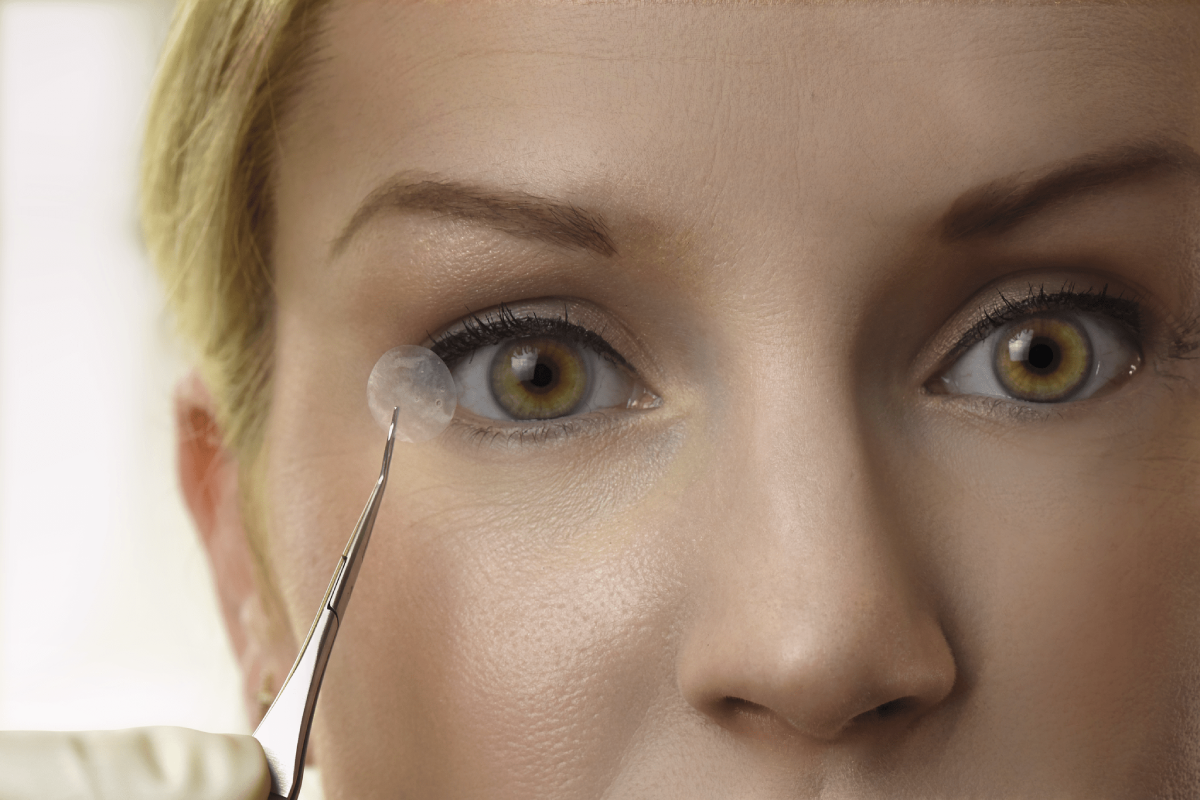 Amniotic Membrane a natural healing bandage for dry eye disease treatment
